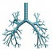 Atelektáza pravého pľúcneho krídla na podklade bronchogénneho karcinómu