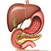 Acute abdomen - gallstone ileus