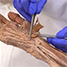 Anatomická pitva - horná končatina