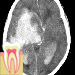 annotation image