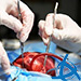 CLEVER Cardiac Surgery Virtual Patients Cases