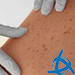 CLEVER Dermatology Virtual Patients Cases