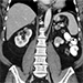 Congenital anomalies of the urogenital system