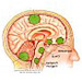 Cranial nerves