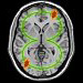 annotation image