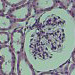 annotation image