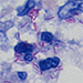 Mycobacteriaceae