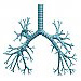 Total atelectasis of the right lung due to bronchogenic carcinoma