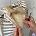Videá k praktickým cvičeniam z anatómie - horná končatina